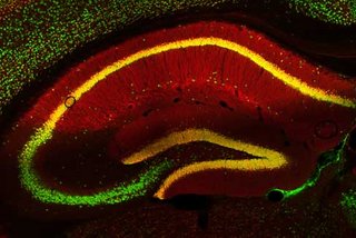 Mikroskopaufnahme von Nervenzellen eines Mäusegehirns
